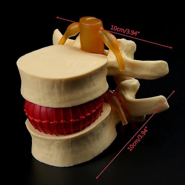 Medicinsk rekvisita Modell Gratis porto Anatomisk ryggrad Ländskivebråck Anatomi Medicinskt läromedel