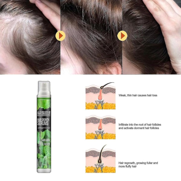 Hår Anti-fall Spray Anti-håravfall Hårlinje