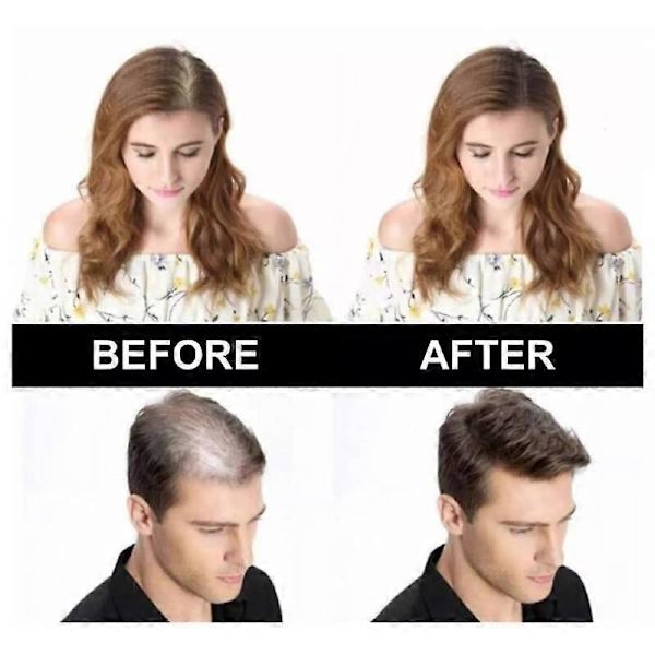 Vandfast Hårfarvepulver HAIR ROOT TOUCH UP - Skjul hårtab, Tilbagegående Hårfæste, Tyndt hår Skaldede Pletter