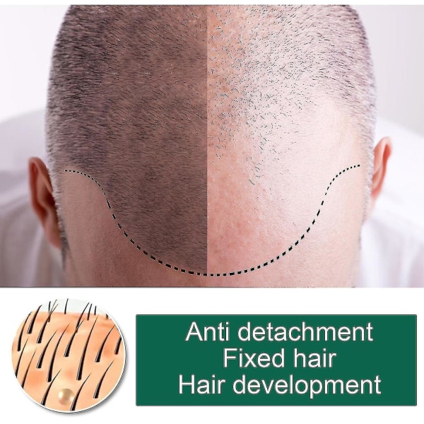 Hår Anti-fall Spray Anti-håravfall Hårlinje