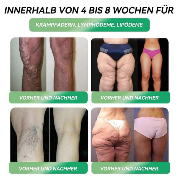 7-pack orallösning för stöd av kroppens kurvor, förpackning 35pcs