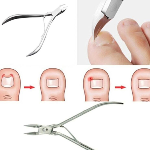 2st Inåtväxande tånaglar Pedikyr Fotvårdsverktyg Nagelkorrigering C one size