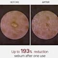 Melexexing Hudljusande Exfolierande Risampuller (Vitt Ris/Svart Ris) 80ml Vit