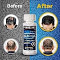 Kirkland 5% Minoxidil Anti-Håravfallsspray 6 x 60 ml (Unisex)