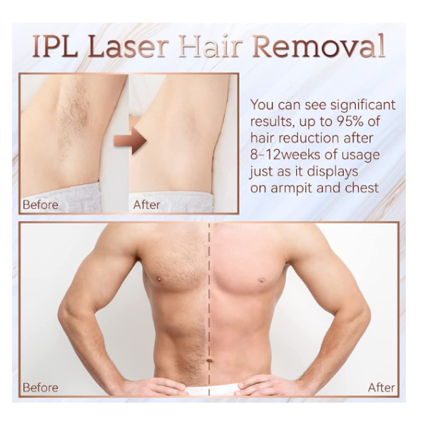 Hemma IPL-hårborttagning för kvinnor och män, Permanent laserhårborttagning 999900 Blixtar för ansiktsben Armar Helkroppsbehandling, vit