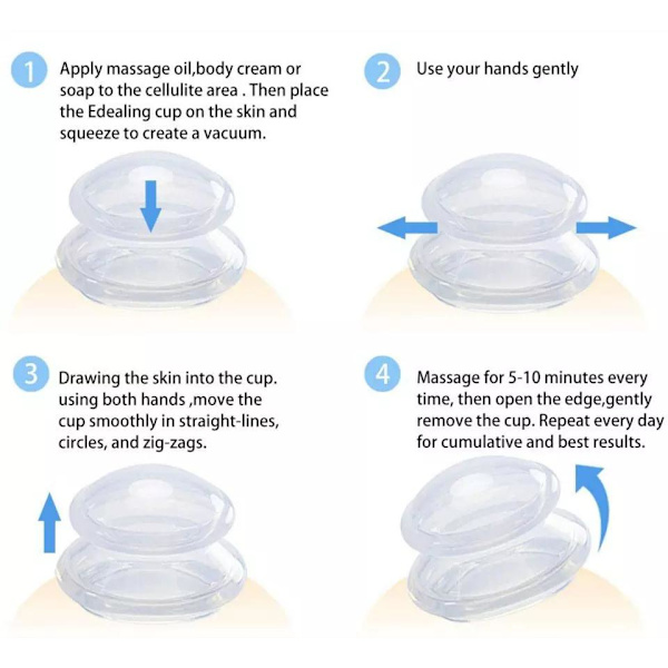 3-pak - Cupping Sæt - Cupping Massagekopper - Cupping