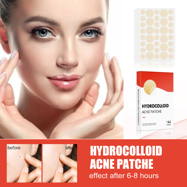 2 Pack(144 Count/Pack) Hydrokolloid Acne Pimpple Patch för Coverin