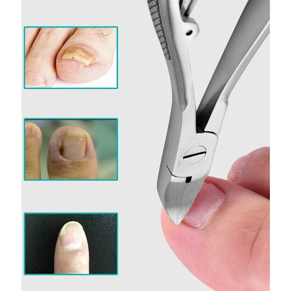 Professionelle fødder tånegl klippere trimmer paronychia nipper podiatri podiatri rustfrit stål fodpleje værktøjer