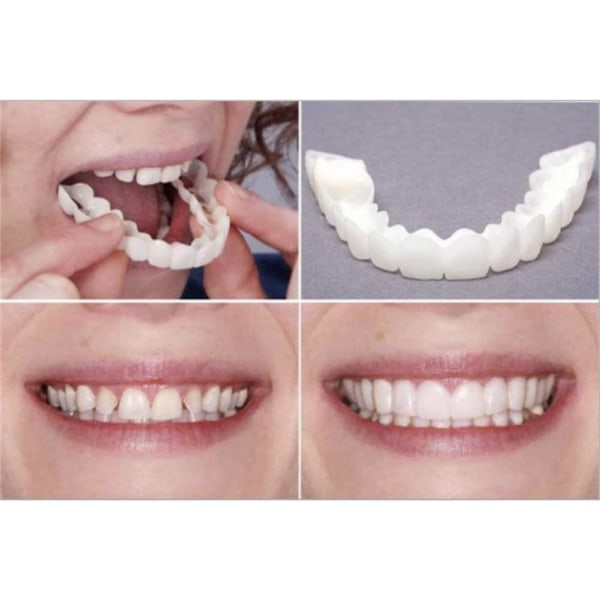 Klistermärken för tandproteser, Magic Teeth tillfälliga kosmetiska tänder, tillfälligt leende bekväm passform elastiska kosmetiska tänder, tillfällig buckla upptill och nedtill