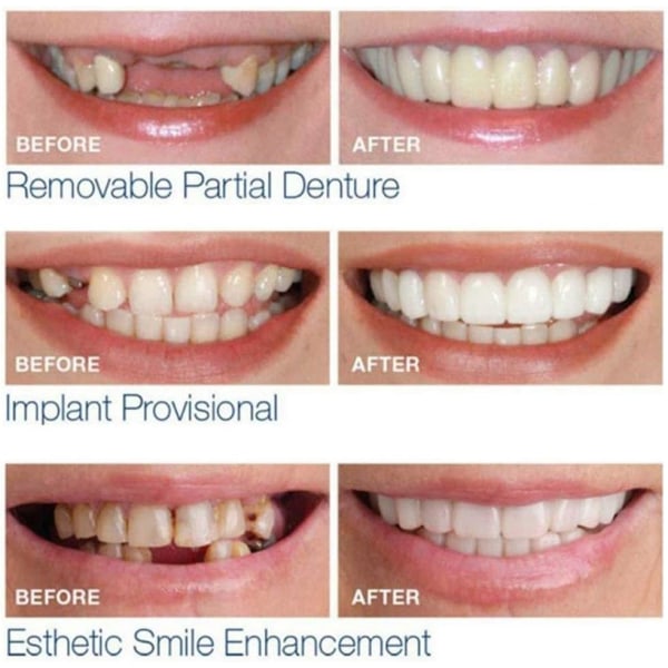 Klistremerker til tannproteseseler, Magic Teeth midlertidige kosmetiske tenner, midlertidig smil komfortabel passform elastiske kosmetiske tenner, midlertidig bulk øverst og nederst