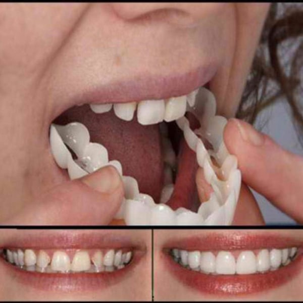 Dekaler för tandprotesfäste, tillfälliga kosmetiska tänder (5 par)
