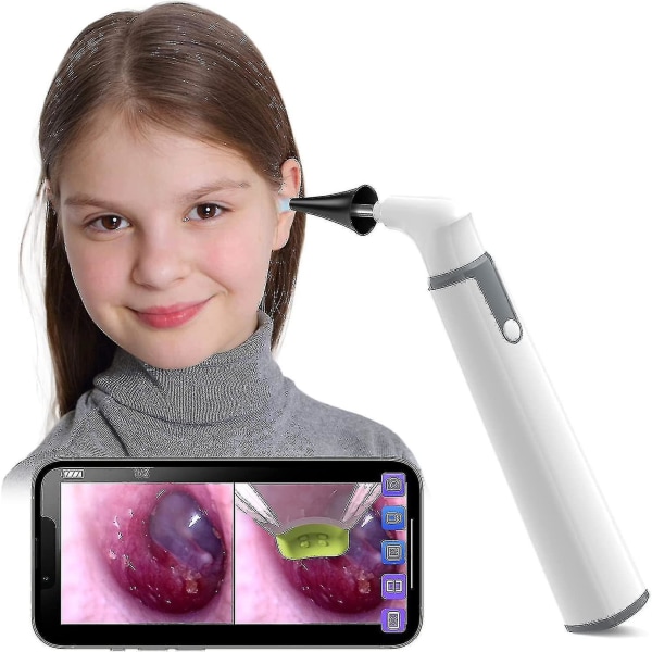 Trådlös Otoscope Ear Camera med Dual View, 3,9 mm 720phd Wifi Ear Scope med 6 LED-lampor