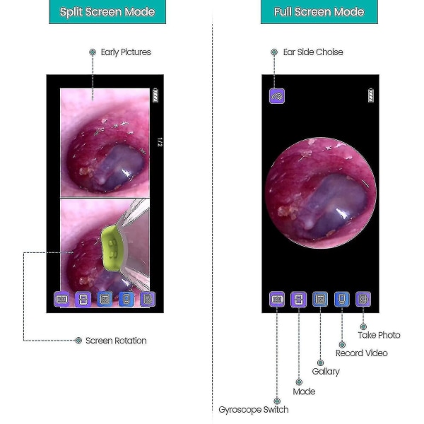 Langaton otoskooppi korvakamera kaksoisnäkymällä, 3,9 mm 720phd Wifi-korvaskooppi 6 LED-valolla