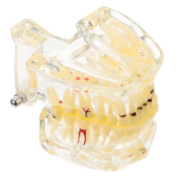 10X8CM Dentala verktygsuppsättningar 1st harts tandimplantat tänder modell Ove