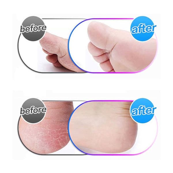 Pakke med 10 rulle hoveder kompatible med Emjoi Micro Pedi Nano, erstatningshoveder