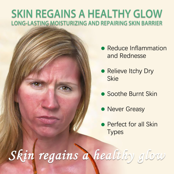 OUHOE Aloe Vera Sunburn Gel - Skin Repair Gel #2 100g