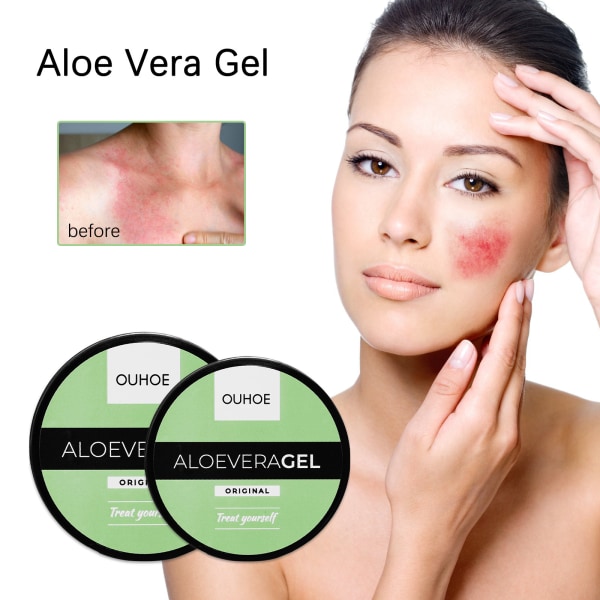 OUHOE Aloe Vera Sunburn Gel - Skin Repair Gel #1 50g