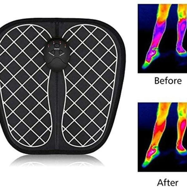 Fot Stim Pro Fysioterapi Massasjematte, Sammenleggbar Bærbar Elektrisk Massasjematte, Fot Akupunkturpunkt Massasjematte som Fremmer Blodsirkulasjon Muskel Smertelindring (2PCS, Rund)