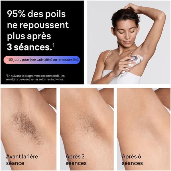 Semi-permanent epilering Braun Skin i-expert 7 PL7211 Roséguld, vit