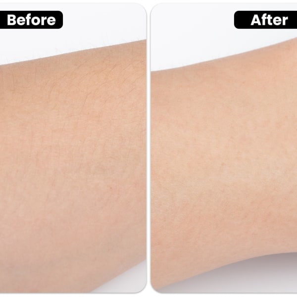 Ansiktsbarberingssett for kvinner 3 stk Eyebrow Razor Shaper Øyenbryns trimmer Ansiktshår Peach Fuzz Remover (farget)