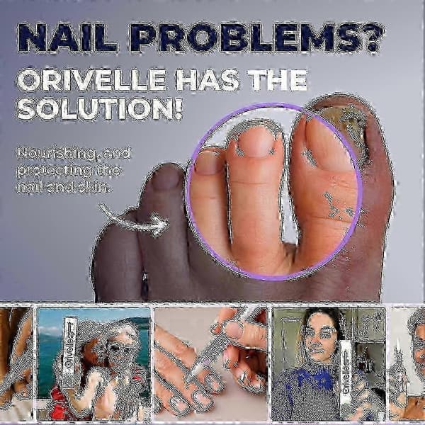 Extra stark svampbehandlingspenna för tånaglar och fingernaglar - Stöder hälsosam nageltillväxt styww 3pcs