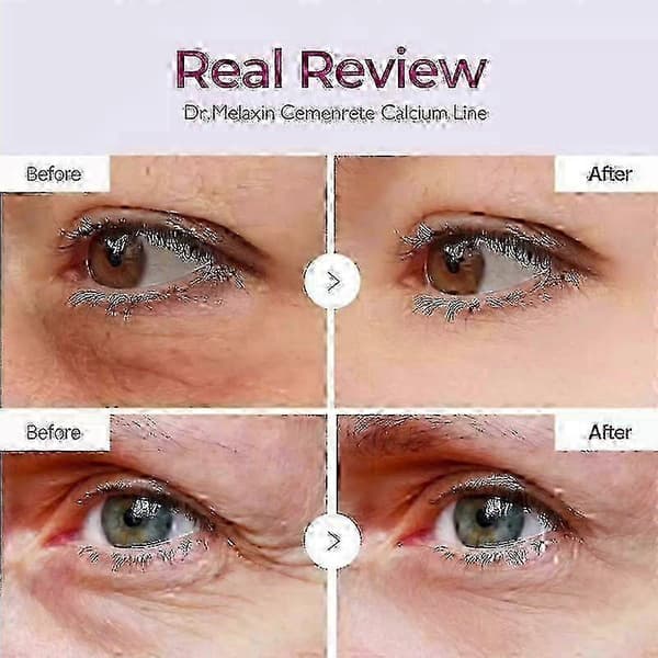 3X Dr.Melaxin Cemenrete Calcium Volume Multi Balm Wrinkle Core Stick K-beauty_jsaf