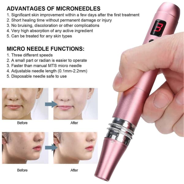Professionell Derma Pen Mikronål 3 Växlar Justering Anti-Aging Terapi Hudapparat Rosa