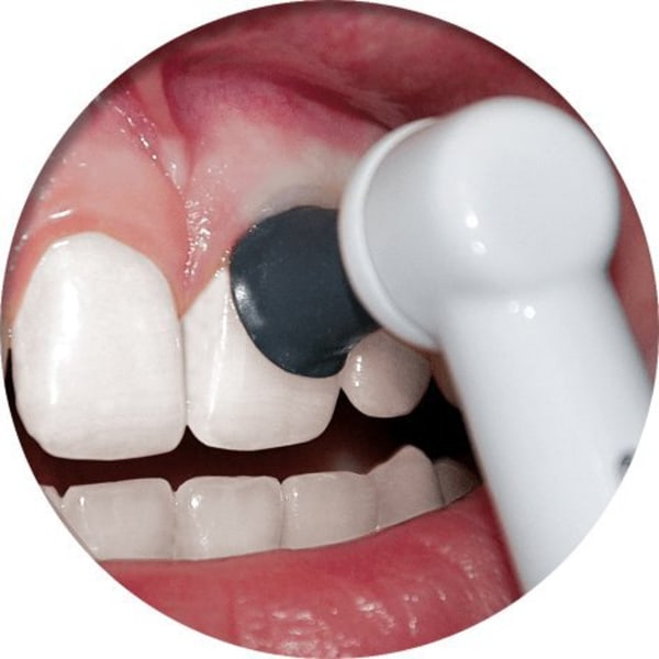 Poler selv - Passer til OralB el-tandbørste - inkl. 2x2 gram polerpasta White