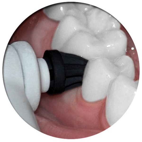 Poler selv - Passer til OralB el-tandbørste - inkl. 2x2 gram polerpasta White