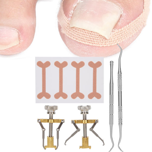 5 st Pedikyrverktyg Set Inväxt tånagel Ortos Korrigering Fixer Patch Manikyrvård