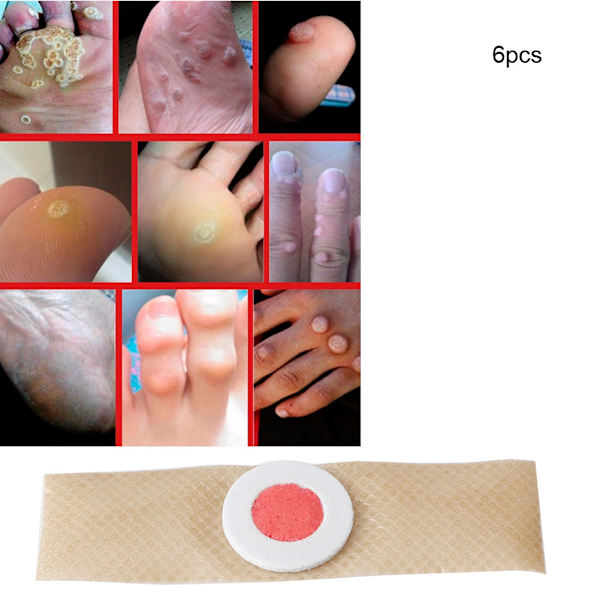 6 stk/pose Fodmajsfjerner Plaster Vorter Torn Plaster Fødder Callus Fjernelse Smertelindring Mærkater
