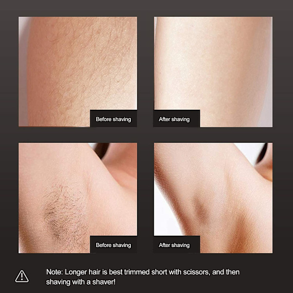 Hår Fjernelse Epilator, Bærbar Elektrisk Epilator Kropshår Fjernelse Trimmer Vandtæt Vådt Tørt Brug Til Kvinder Dame