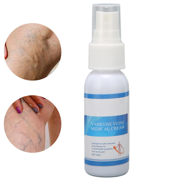 Åreknuder Behandling Spray Lindre Smerter Forbedre Cirkulation Glat Hud Ben Vene Spray 30ml