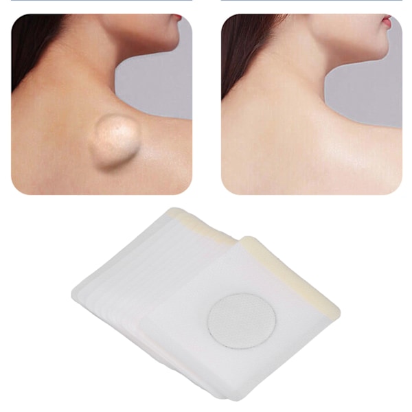 12 stk Lipoma Relief Patch beroligende reduserer ømhet urte Lipoma fjerningspute for fettknute