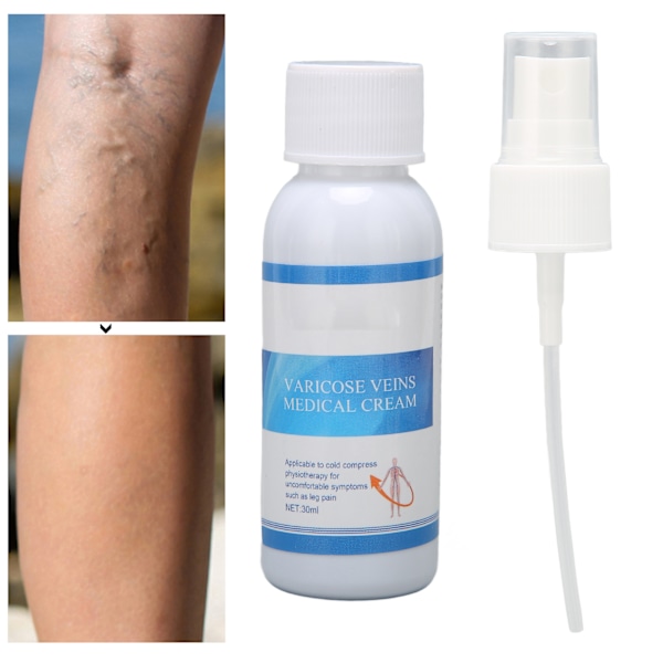 Spray för behandling av åderbråck, lindrar smärta, förbättrar cirkulationen, jämnar ut huden, benvenspray 30 ml
