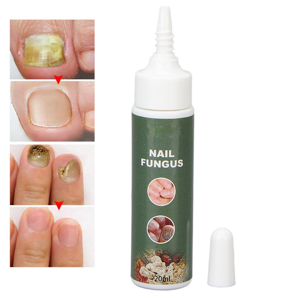 3 st/set Pinsett Död Hud Gaffel Remover Nagelbandsskrapa Nagelkonst Pedikyr Manikyr Verktyg Set3 st/set