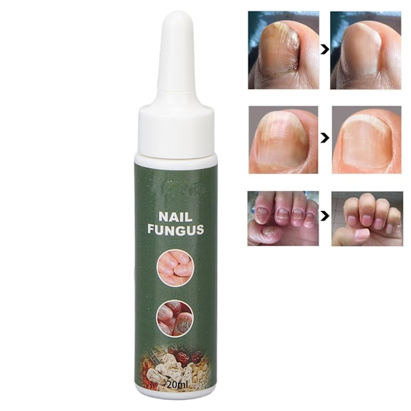 3 st/set Pinsett Död Hud Gaffel Remover Nagelbandsskrapa Nagelkonst Pedikyr Manikyr Verktyg Set3 st/set