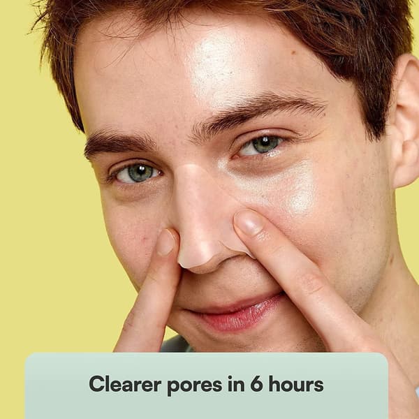 Nose Pore Strips XL 10-pack SKIN CHOICE