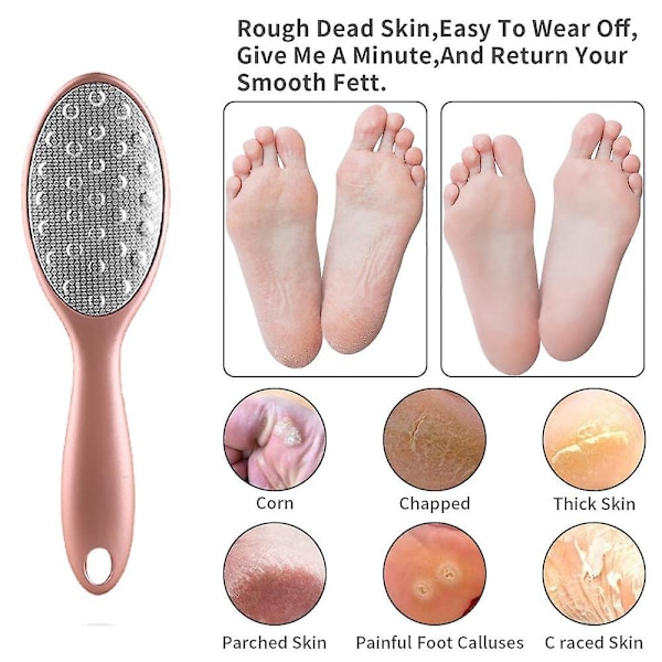 Fodrasp Fodfil Fodpleje Pedicure Metaloverfladeværktøj til fjernelse af hård hud, fil i rustfrit stål rose gold