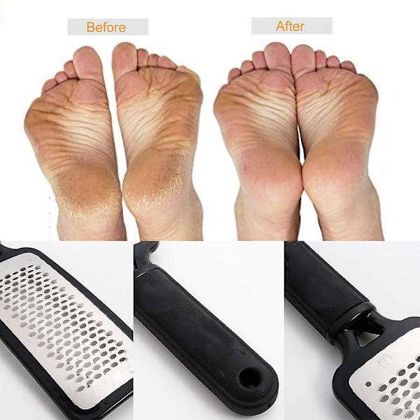 Fotfil Callus Remover, professionell fotfil Pedikyr Kit, kirurgiskt rostfritt stål black