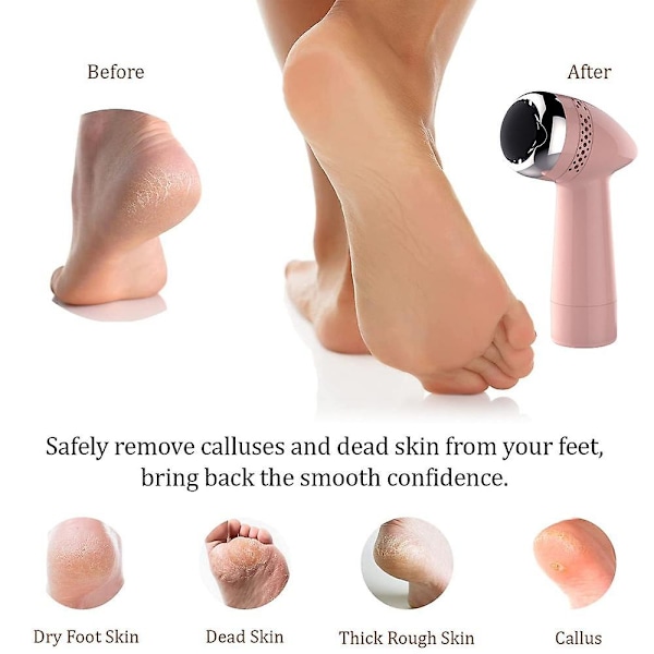 Elektrisk fil og callusfjerner, genopladelig fodsliber, pedicure fodfil callusfjerner 1200mAh (pink silver)