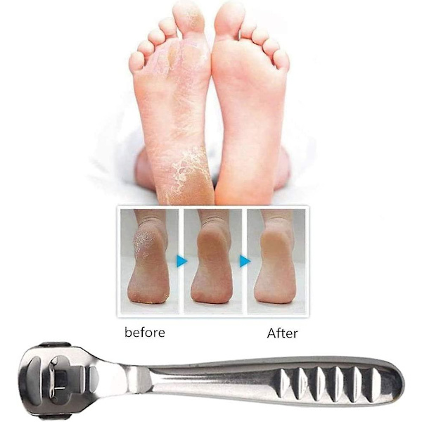 Hård Hud Høvl Fodfil, Rustfri Stål Rasp Filer Til Fodpleje Pedicure Hård Hud Høvl Barberkniv Med Æske, Fodfilhoveder Og 10 Ekstra Blade