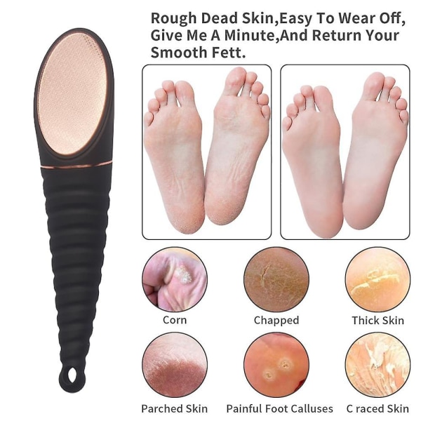 Dead Skin Remover For Feet - Pedikyr Foot Egg File Callus Remover Och Fotskalare Black with rose gold glass