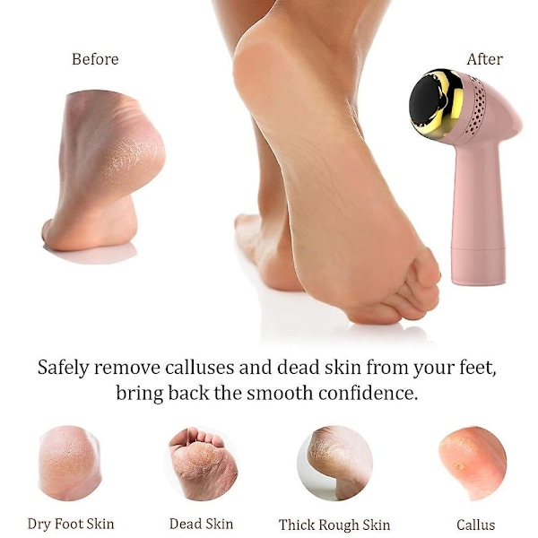 Elektrisk fil og callusfjerner, genopladelig fodsliber, pedicure fodfil callusfjerner 2000mAh (pink gold)