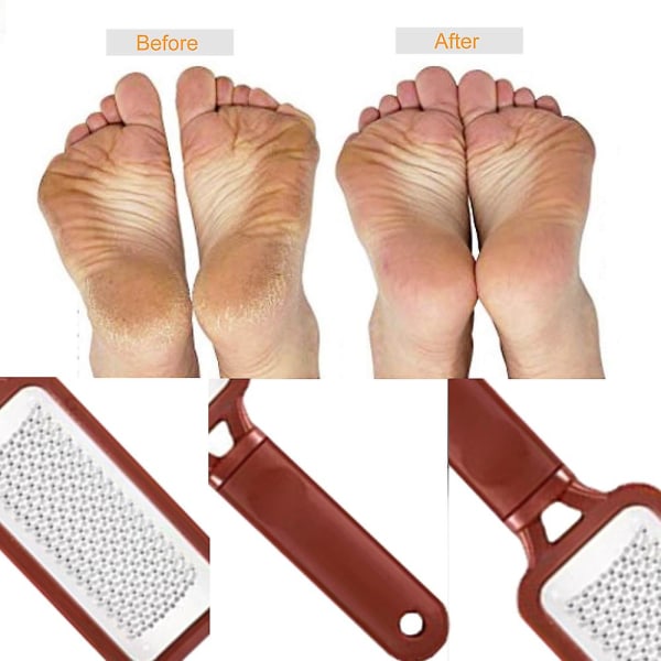 Fodfil til fjernelse af hård hud, professionelt fodskrubbersæt til pedicure, kirurgisk rustfri stålfodfil brown
