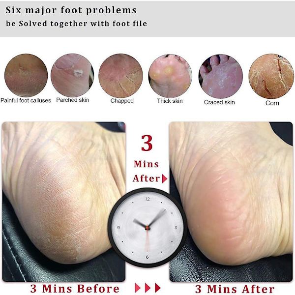 Fotrasp & Kallushøvel med Trehåndtak, Pedikyr Fotfilsett, Hælskrape for Føtter Foot Planer (Black)