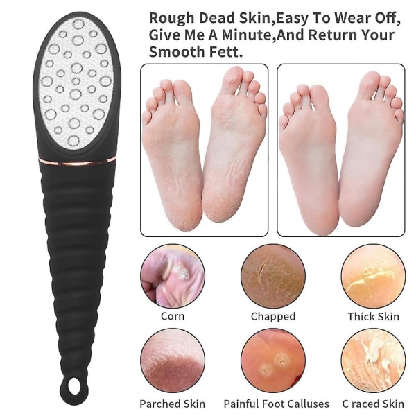 Dead Skin Remover For Feet - Pedikyr Foot Egg File Callus Remover Och Fotskalare Black 304 Stainless Steel