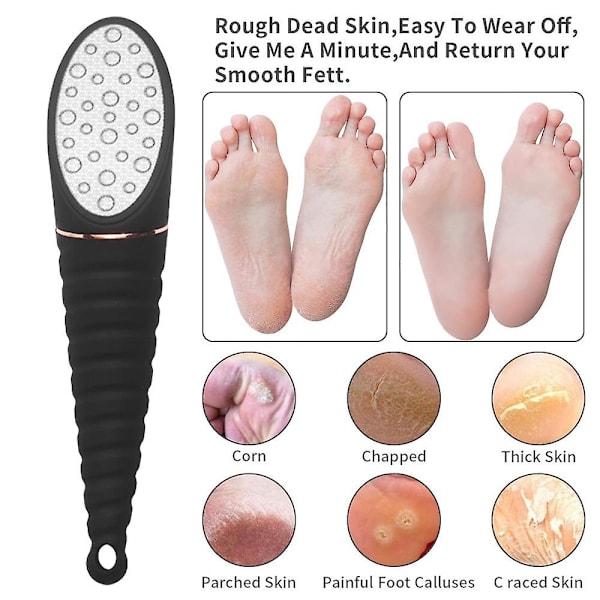 Død Hudfjerner til Fødder - Pedicure Fod Æg Fil Hård Hudfjerner og Fod Peeling Black 304 Stainless Steel