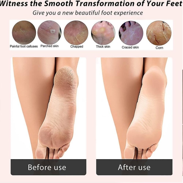 Elektrisk fotfil Callus Remover Professionell Justerbar Hastighet Callus Shaver Torr Hård Hud Calluses black