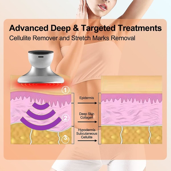 Cellulite Massager Professionel Kropsskulptur Maskine Trådløs Elektrisk Kropsmassager Til Mavefedt, Talje, Arm, Ben, Balde Massager Til Kvinder B